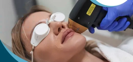 depilacion-laser-bozo-mendez