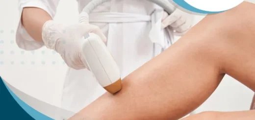 beneficios-depilacion-laser-soprano-piernas